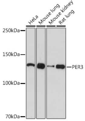 Western Blot: PER3 Antibody (9I3I6) [NBP3-16094]