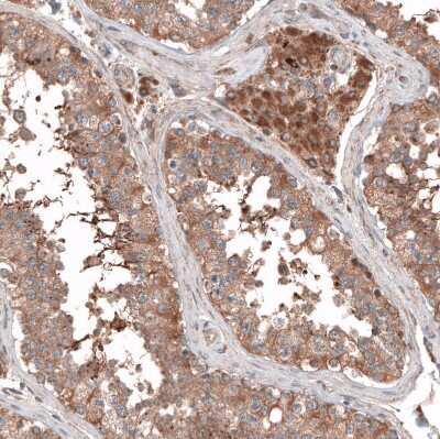 Immunohistochemistry-Paraffin: PER3 Antibody [NBP1-86436]