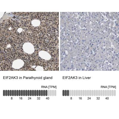 Immunohistochemistry-Paraffin: PERK Antibody [NBP1-80930]