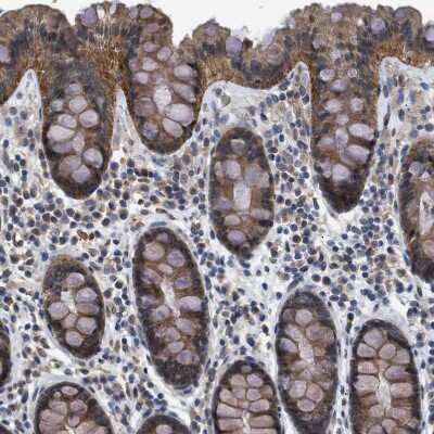 Immunohistochemistry-Paraffin: PERK Antibody [NBP1-80930]