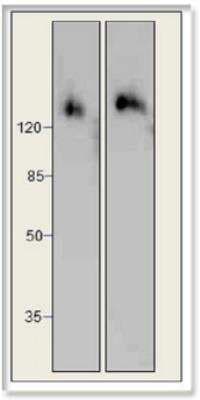 Western Blot: PERK Antibody [NBP3-12193]