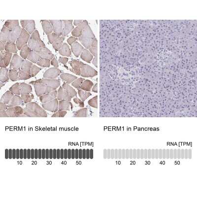 Immunohistochemistry-Paraffin: PERM1 Antibody [NBP1-93520]