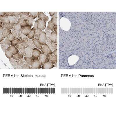 Immunohistochemistry-Paraffin: PERM1 Antibody [NBP2-48616]
