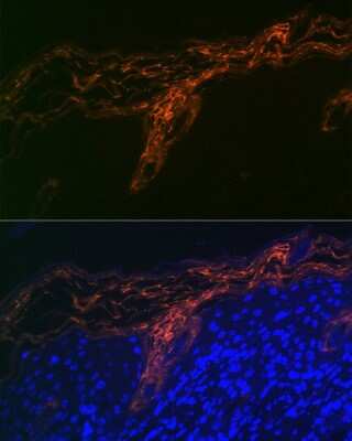 Immunohistochemistry: PERP Antibody (1O3L5) [NBP3-16617]