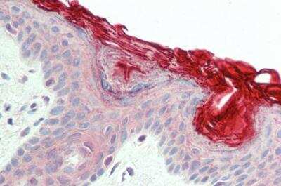 Immunohistochemistry-Paraffin: PERP Antibody [NB100-2912]