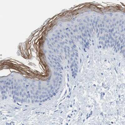 Immunohistochemistry-Paraffin: PERP Antibody [NBP1-85173]