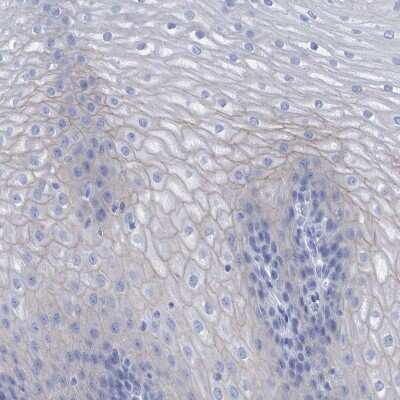 Immunohistochemistry-Paraffin: PERP Antibody [NBP1-85173]