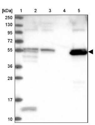 Western Blot: PET112L Antibody [NBP1-80925]