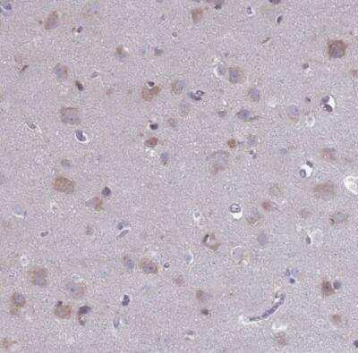 Immunohistochemistry-Paraffin: PET117 Antibody [NBP2-14613]