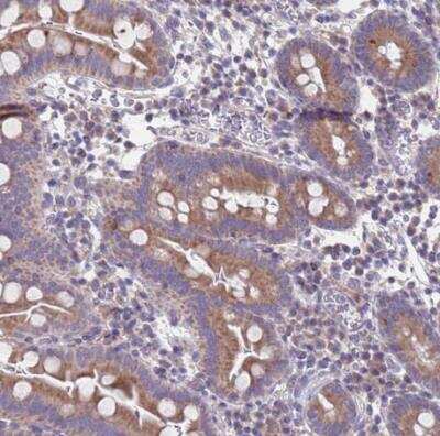 Immunohistochemistry-Paraffin: PET117 Antibody [NBP2-14613]