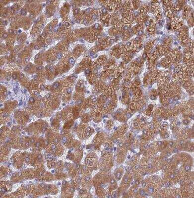 Immunohistochemistry-Paraffin: PET117 Antibody [NBP2-14613]