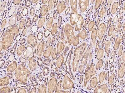 Immunohistochemistry-Paraffin: PET117 Antibody [NBP2-97948]