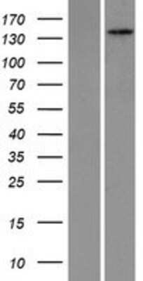 Western Blot: PEX1 Overexpression Lysate [NBP2-09026]