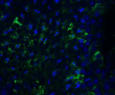 Immunohistochemistry: PEX10 Antibody - BSA Free [NBP3-18137]
