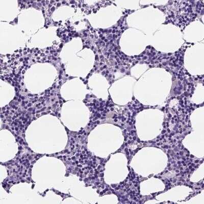 Immunohistochemistry-Paraffin: PEX12 Antibody [NBP2-49599]