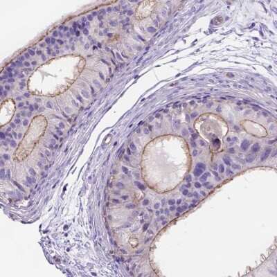 Immunohistochemistry-Paraffin: PEX12 Antibody [NBP2-49599]