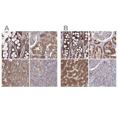 Immunohistochemistry-Paraffin: PEX13 Antibody [NBP2-38204]