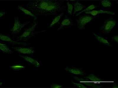 Immunocytochemistry/ Immunofluorescence: PEX14 Antibody [H00005195-B01P]