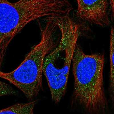 Immunocytochemistry/ Immunofluorescence: PEX19 Antibody [NBP2-55465]