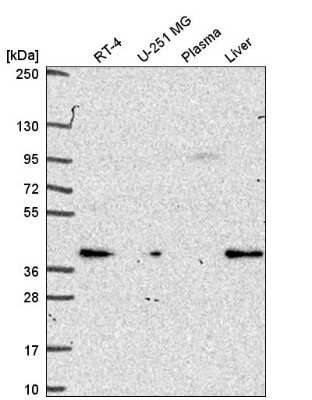 Western Blot: PEX19 Antibody [NBP2-55465]