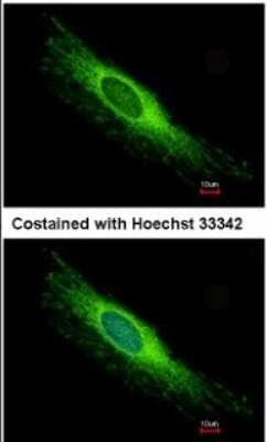 Immunocytochemistry/ Immunofluorescence: PEX26 Antibody [NBP1-32743]