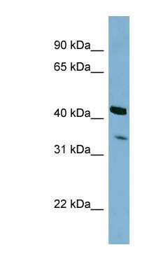 Western Blot: PEX26 Antibody [NBP1-55114]