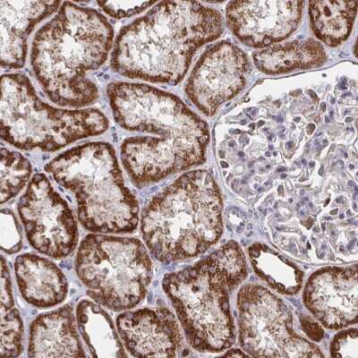 Immunohistochemistry: PEX3 Antibody [NBP2-38838]