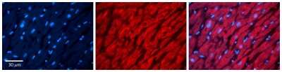 Immunohistochemistry: PEX5 Antibody [NBP1-54597]