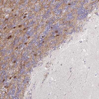 Immunohistochemistry: PEX5L Antibody [NBP2-38840]
