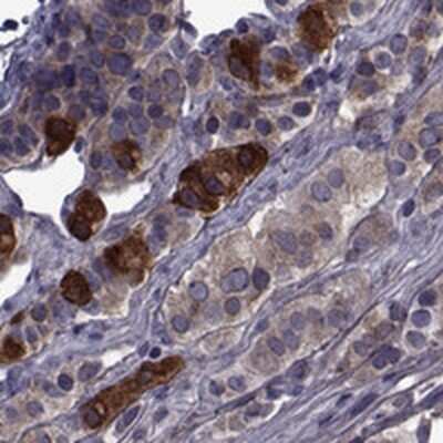 Immunohistochemistry-Paraffin: PEX5L Antibody [NBP2-38840]