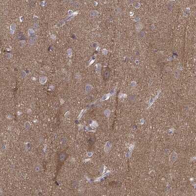 Immunohistochemistry-Paraffin: PEX5L Antibody [NBP2-38840]