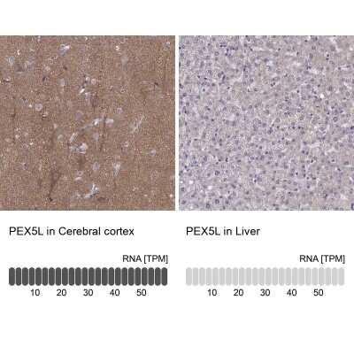 Immunohistochemistry-Paraffin: PEX5L Antibody [NBP2-38840]
