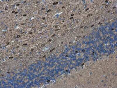 Immunohistochemistry-Paraffin: PEX5L Antibody [NBP3-13189]