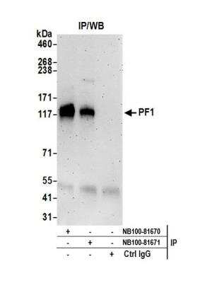 Immunoprecipitation: PF1 Antibody [NB100-81671]