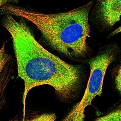 Immunocytochemistry/ Immunofluorescence: PFDN2 Antibody [NBP1-86378]