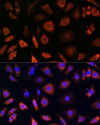 Immunocytochemistry/ Immunofluorescence: PFDN4 Antibody - Azide and BSA Free [NBP2-93935]