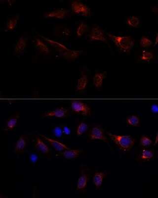 Immunocytochemistry/ Immunofluorescence: PFDN4 Antibody - Azide and BSA Free [NBP2-93935]