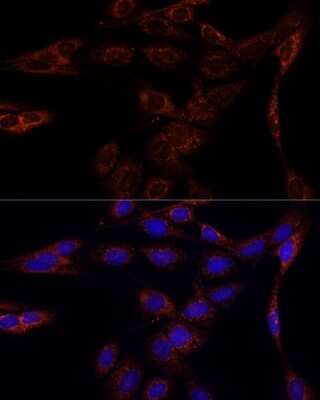 Immunocytochemistry/ Immunofluorescence: PFDN4 Antibody - Azide and BSA Free [NBP2-93935]