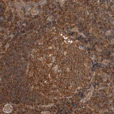 Immunohistochemistry-Paraffin: PFDN4 Antibody [NBP1-88526]