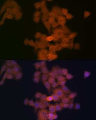 Immunocytochemistry/ Immunofluorescence: PFDN5 Antibody (9Y5H7) [NBP3-16331]