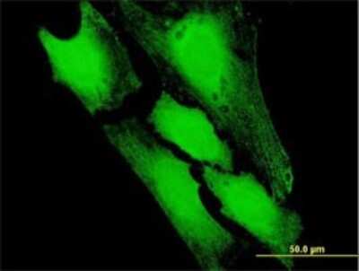 Immunocytochemistry/ Immunofluorescence: PFDN5 Antibody [H00005204-B03P]