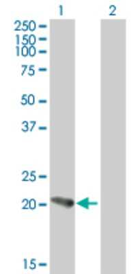 Western Blot: PFDN5 Antibody [H00005204-B03P]