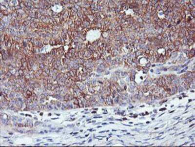 Immunohistochemistry-Paraffin: PFDN6 Antibody (OTI4E10) [NBP2-01637]