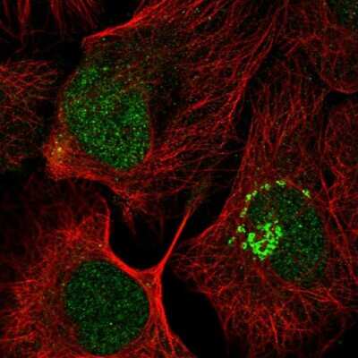 Immunocytochemistry/ Immunofluorescence: PFDN6 Antibody [NBP2-47335]