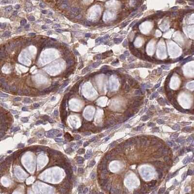 Immunohistochemistry-Paraffin: PFDN6 Antibody [NBP2-30389]