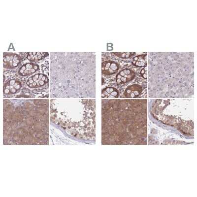 Immunohistochemistry-Paraffin: PFDN6 Antibody [NBP2-47335]