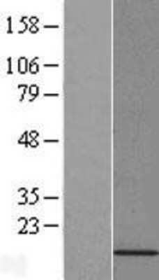 Western Blot: PFDN6 Overexpression Lysate [NBL1-14310]