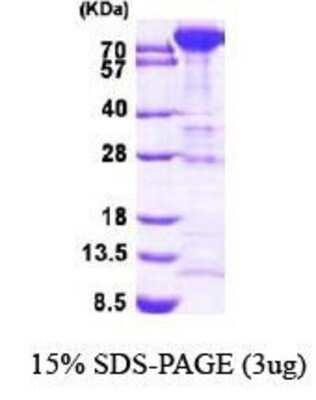 SDS-PAGE: Recombinant Human Muscle Phosphofructokinase/PFKM/PFK-1 His Protein [NBP1-44494]