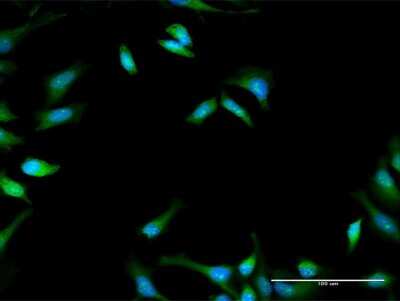 Immunocytochemistry/ Immunofluorescence: PFKFB1 Antibody [H00005207-D01P]
