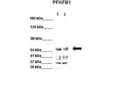 Western Blot: PFKFB1 Antibody [NBP2-84217]